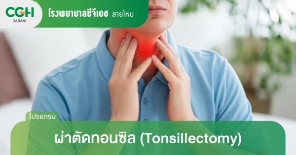 ผ่าตัดทอนซิล (Tonsillectomy)